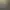 Falsos positivos de cáncer de colon: una "incidencia técnica" altera los resultados de los cribados en Málaga